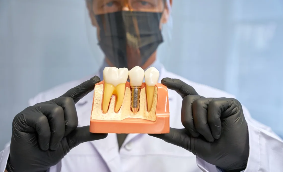 Czy mając cukrzyce można wszczepić implanty zębowe